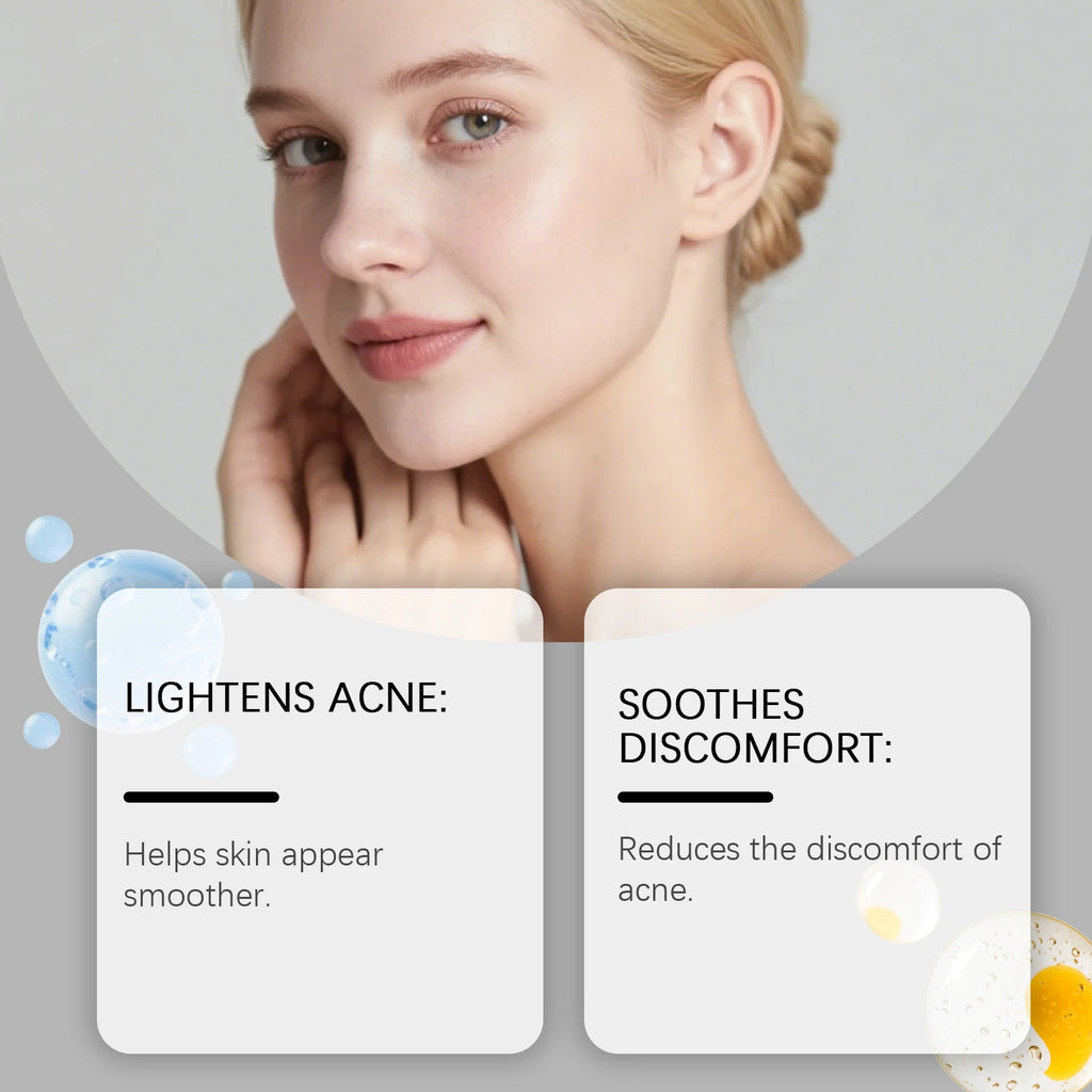 Acne Patches 80 Pcs Salicylic Acid Hydrocolloid Invisible Pimple Patches for Face Blemish Treatment Comedones Care Skin-friendly